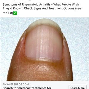 Meet your Posher, Marlon